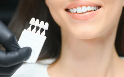 How Long Does Teeth Whitening Last?