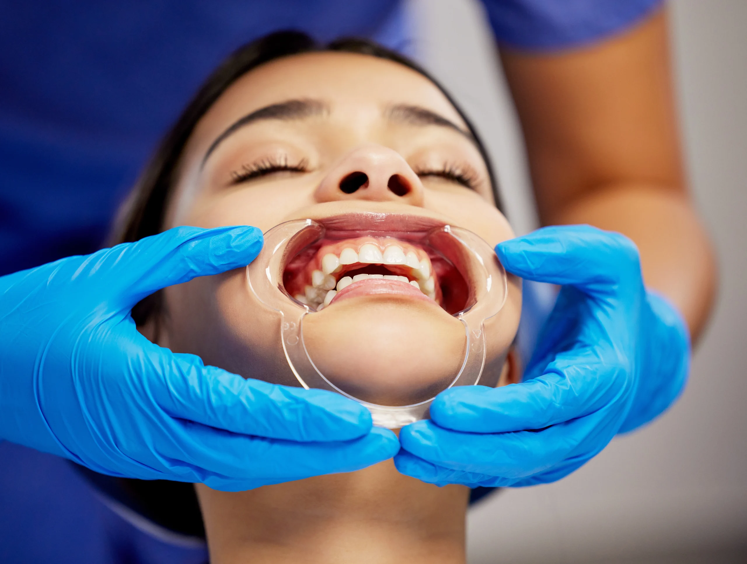 invisalign brookvale